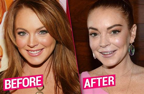 lindsay lohan face tattoo|lindsay lohan before plastic surgery.